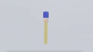 TLab™ PRP Kit  Pure PRP Protocol [upl. by Bucella]