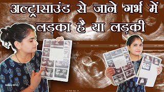 प्रेगनेंसी में मैंने कैसे जाना गर्भ में लड़का है या लड़की  Ultrasound se jane garbh me ladka ya ladki [upl. by Anev]