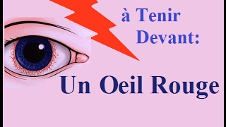 Oeil Rouge Douloureux avec Vision Flou Conduite à Tenir Les Causes et Traitements [upl. by Dale]