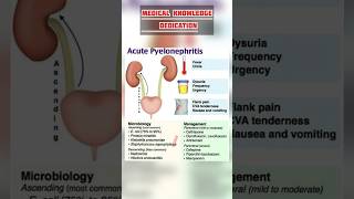 Acute pyelonephritis symptoms  Acute pyelonephritis Management [upl. by Erskine]