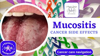 Understanding Mucositis A Side Effect from Cancer Treatment  Symptoms Management amp Home Remedies [upl. by Shirlie]