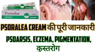 Psoralea CreamOintment Benefits Uses How to Apply Price in Hindi  Eczema Psoriasis Vitiligo [upl. by Ranchod]