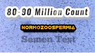 Normozoospermia semen Analysis [upl. by Kcin571]