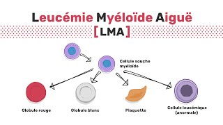 Types de leucémie myéloïde aiguë [upl. by Ataner]