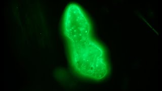 Acridine orange staining for fluorescence  first attempt [upl. by Suirauqram]