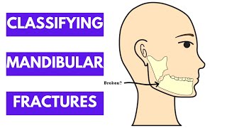 Classification of Mandibular Fractures Oral and Maxillofacial Surgery [upl. by Ahsaet671]