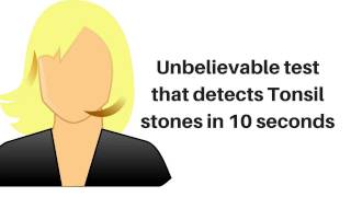 unbelievable test that detects hidden tonsil stones in 10 seconds [upl. by Froh]