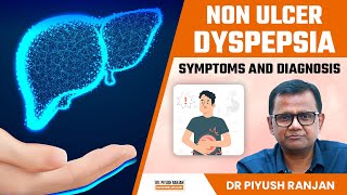 Non Ulcer Dyspepsia क्या होता है  Non Ulcer Dyspepsia Symptoms and Diagnosis  Dr Piyush Ranjan [upl. by Seka492]