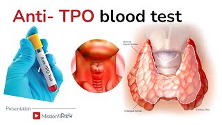 AntiTPO antibodies  treatment for high antiTPO [upl. by Seely977]