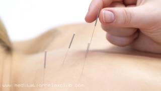 Holistic Healing Music for Acupuncture Session Spa Massage Therapy Music [upl. by Vaughn]