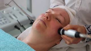 Naaldloze mesotherapie en elasticiteit huid herstellen [upl. by Agace]