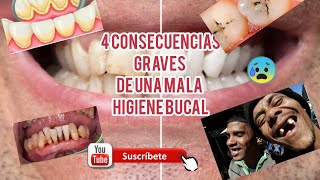 4 CONSECUENCIAS GRAVES DE TENER UNA MALA HIGIENE BUCAL [upl. by Jenna609]