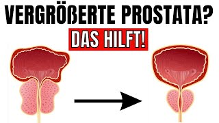 Das ist der wichtigste Nährstoff um deine Prostata zu verkleinern [upl. by Schulz415]