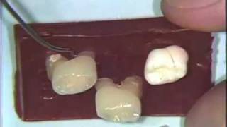 Dental Anatomy Primary Dentition [upl. by Weksler]