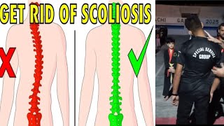 How to fix scoliosis naturally in 5 minutes every day [upl. by Lethia]