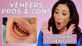 The Cost of Dental Veneers Cosmetic Dentists Share Pros amp Cons  Beauty With Susan Yara [upl. by Ailedamla175]