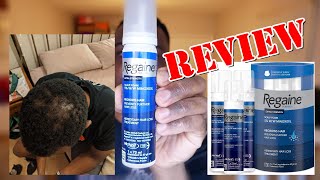 Regaine REVIEW Should you buy Regaine Foam Treatment [upl. by Lilah]