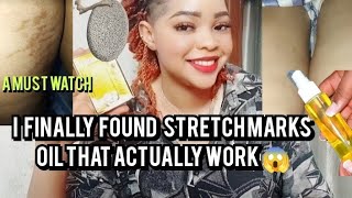 The best stretch marks oil and soapremove stretch marks in just 7 daysstretchmarkssmoothskin [upl. by Aneehsyt]