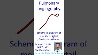 Pulmonary angiography [upl. by Yendis228]