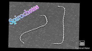 Spirochetes explained in tamil Handwritten notes in Englishmedical microbiology bacteriology [upl. by Beacham]