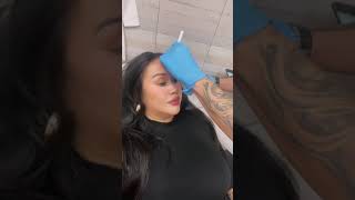 Tracy Tries Dysport with a Master Injector at Novuskin  Wrinkle Smoothing Treatment Results [upl. by Aiouqahs109]