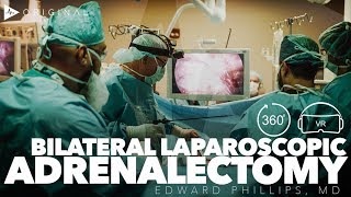 Teaching Bilateral Laparoscopic Posterior Adrenalectomy  Dr Edward H Phillips [upl. by Nibuz]