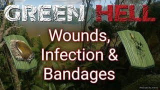 Wounds Infection and Bandages  Green Hell [upl. by Nho]