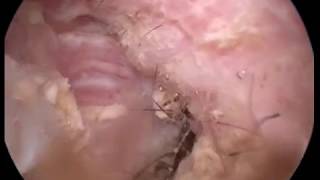 Ear wax cleaning in dog Otoscopy wwwendovetcom [upl. by Ahsot]