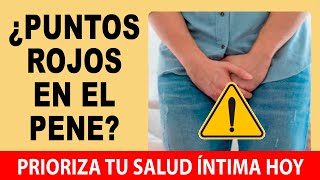 Puntos Rojos En El Glande 💥 Soluciones Efectivas Guía Práctica Sobre La Balanitis [upl. by Einnov]