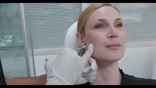 Treating the Masseters Jawline Slimming with Botox [upl. by Haveman387]