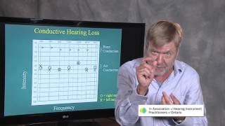 Ted Venema Talks Reading the Audiogram [upl. by Mitch]