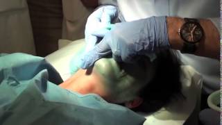 ZO Dr Obagi Controlled Depth Peel Blue Peel 2 [upl. by Artinek]