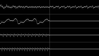 SPC700 Kirby Dream Land 3  Sand Canyon 1 Oscilloscope View [upl. by Akirea304]