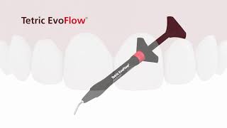 Ivoclar Tetric EvoFlow [upl. by Eiveneg]