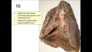 OSPE in anatomy of the respiratory system [upl. by Drofnas]