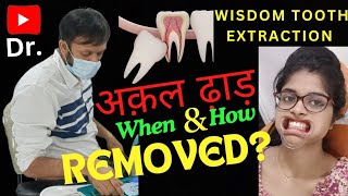 Is Tooth Removed  😭 Wisdom Tooth Surgical Extraction  Painless incision For Impacted Wisdom Tooth [upl. by Dorsy]