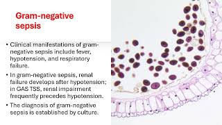 STREPTOCOCCAL TOXIC SHOCK SYNDROME  Streptokokal toksik Şok Sendromu [upl. by Allekim]