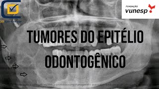 Tumores do Epitélio Odontogênico  CD Concursos [upl. by Paulette480]