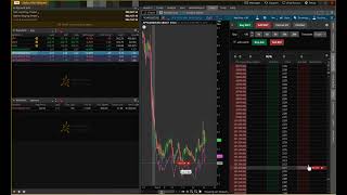 ThinkorSwim Setup For Options Day Trading  Automatic Stop Loss amp Profit Taking [upl. by Holna]