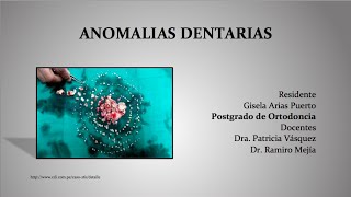 Anomalias Dentarias [upl. by Ivy]