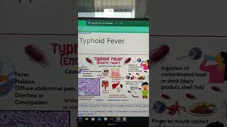 Typhoid widal pathology rapid detection kit gram negative bacteria important must view join [upl. by Greabe]