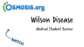 Wilson Disease  Clinical Presentation [upl. by Verneuil242]