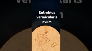 entrobius vermicularis ovum oxyuris الديدان الدبوسية [upl. by Roz166]