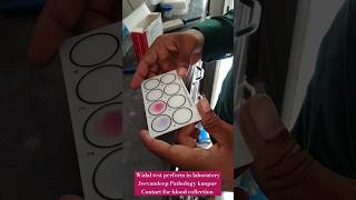 Widal test perform in laboratory by Slide method CBC widal malaria tests shorts viral cbc tests [upl. by Rebhun338]