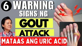 6 Warning Signs ng Gout Attack  By Doc Willie Ong Internist and Cardiologist [upl. by Ellehcsor]