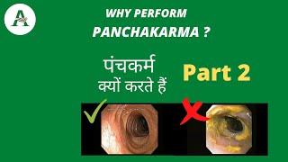 Why perform Panchakarma Treatment Part 2 athreya panchakarma [upl. by Hanako954]