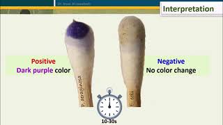 Oxidase Test Five Methods [upl. by Akehsar]