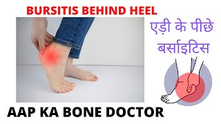 BURSITIS BEHIND HEEL OR RETROCALCANEAL BURSITIS EPISODE 21 [upl. by Demahum]