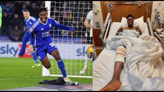 🚨🇬🇭BREAKINGFATAWU ISSAHAKU COMPLETES ACL SURGERY SET TO BE OUT FOR LONG SPELLDETAILS [upl. by Aicertap524]