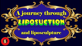 A journey through liposuction and liposculpture Part 610 [upl. by Anehsat]